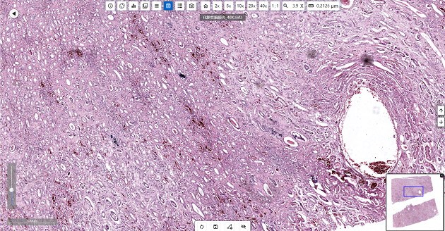 疾控中心病理學實驗室的顯微鏡應用